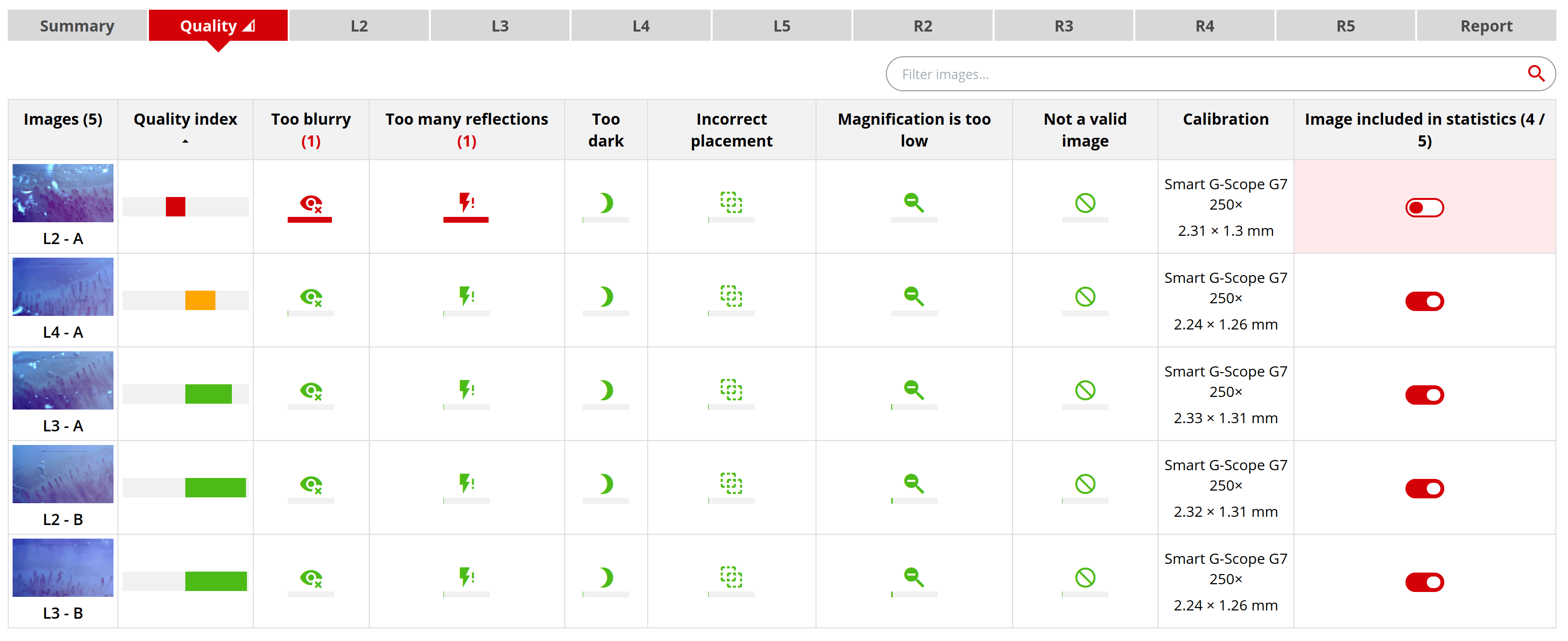 Automatic image quality assessment in Capillary.io