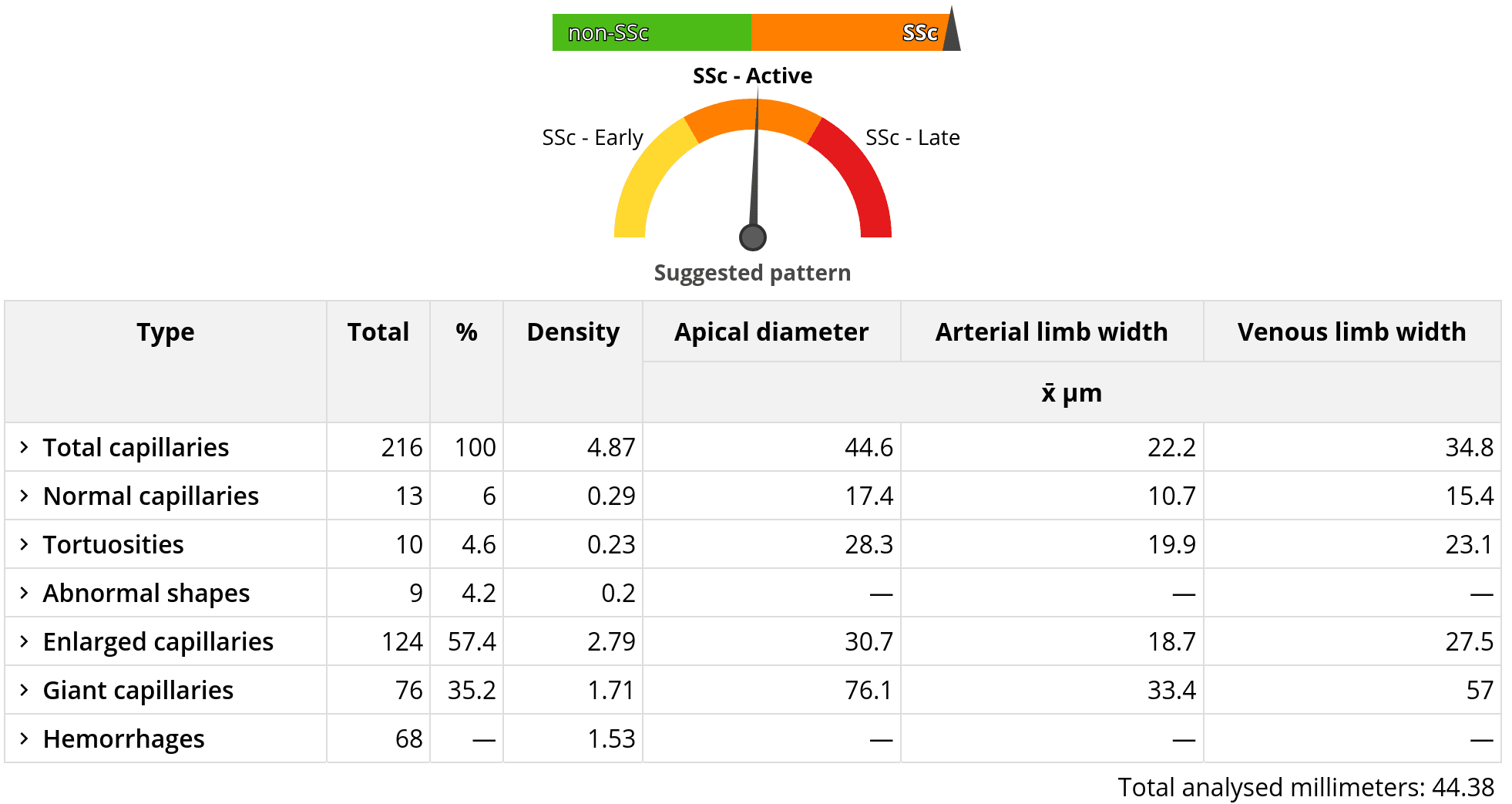 Automatic capillary and hemorrhage detection in Capillary.io
