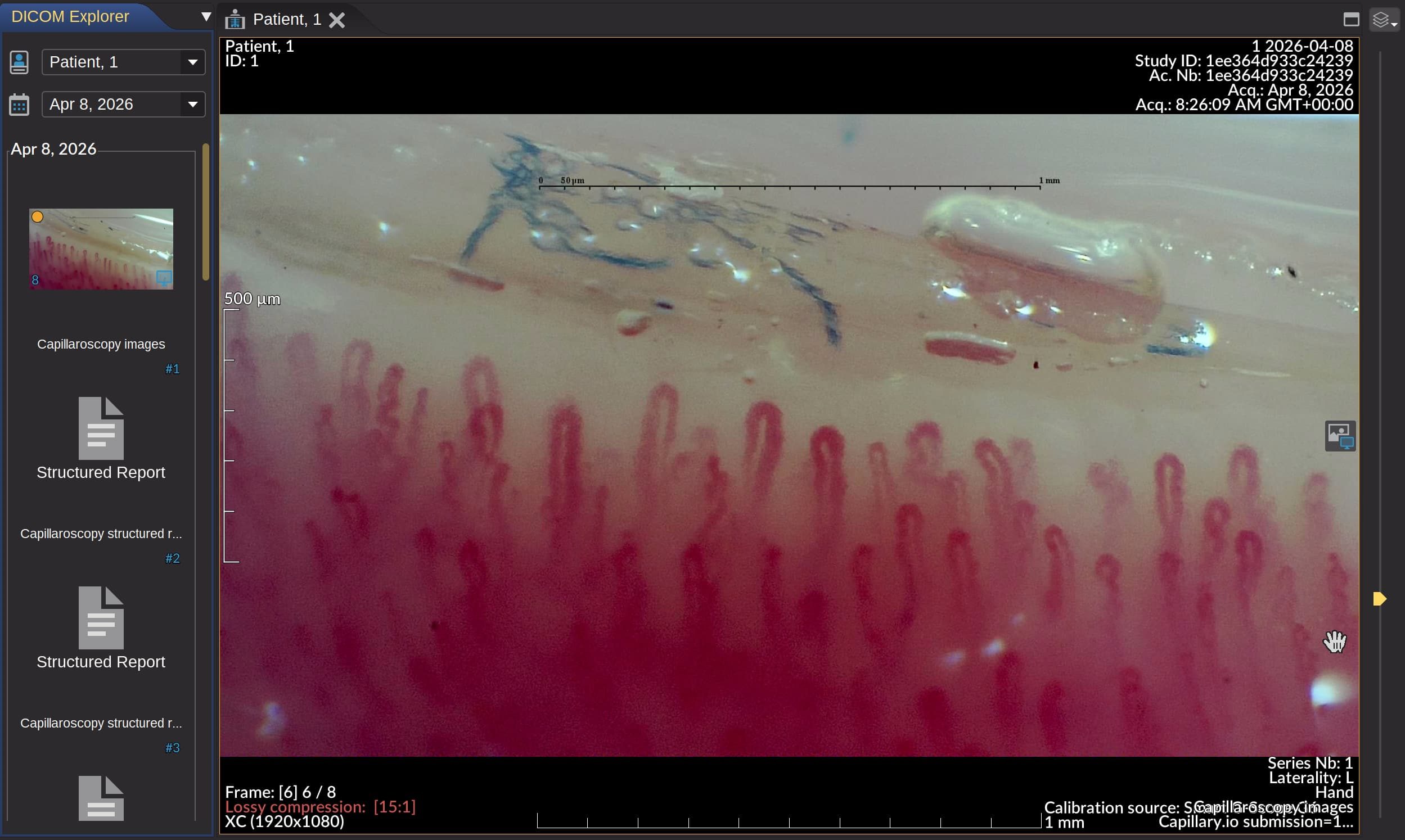 DICOM ZIP export from Capillary.io