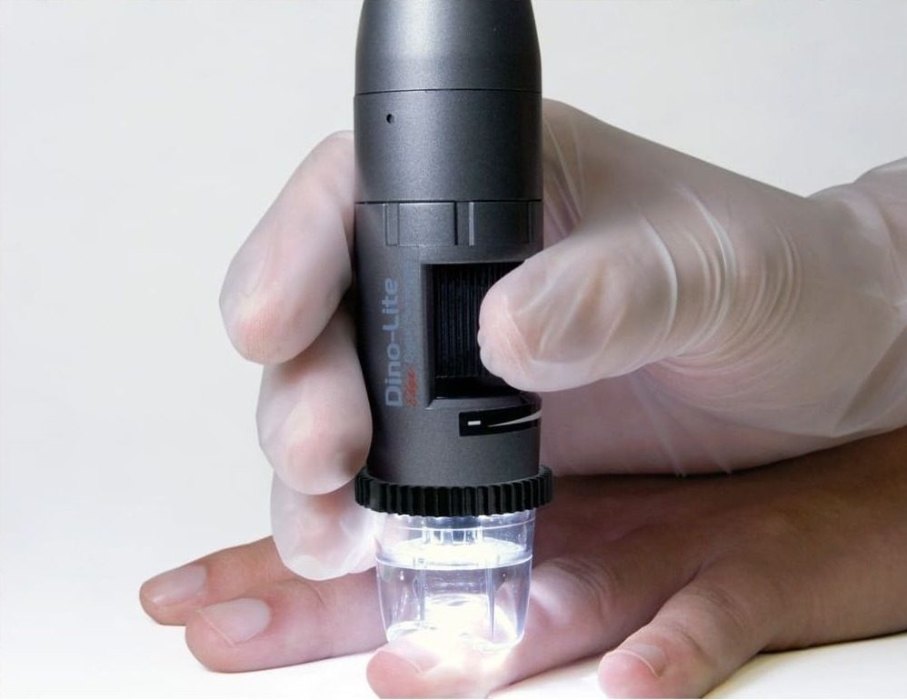 Dino-Lite CapillaryScope 200 Pro for capillaroscopy