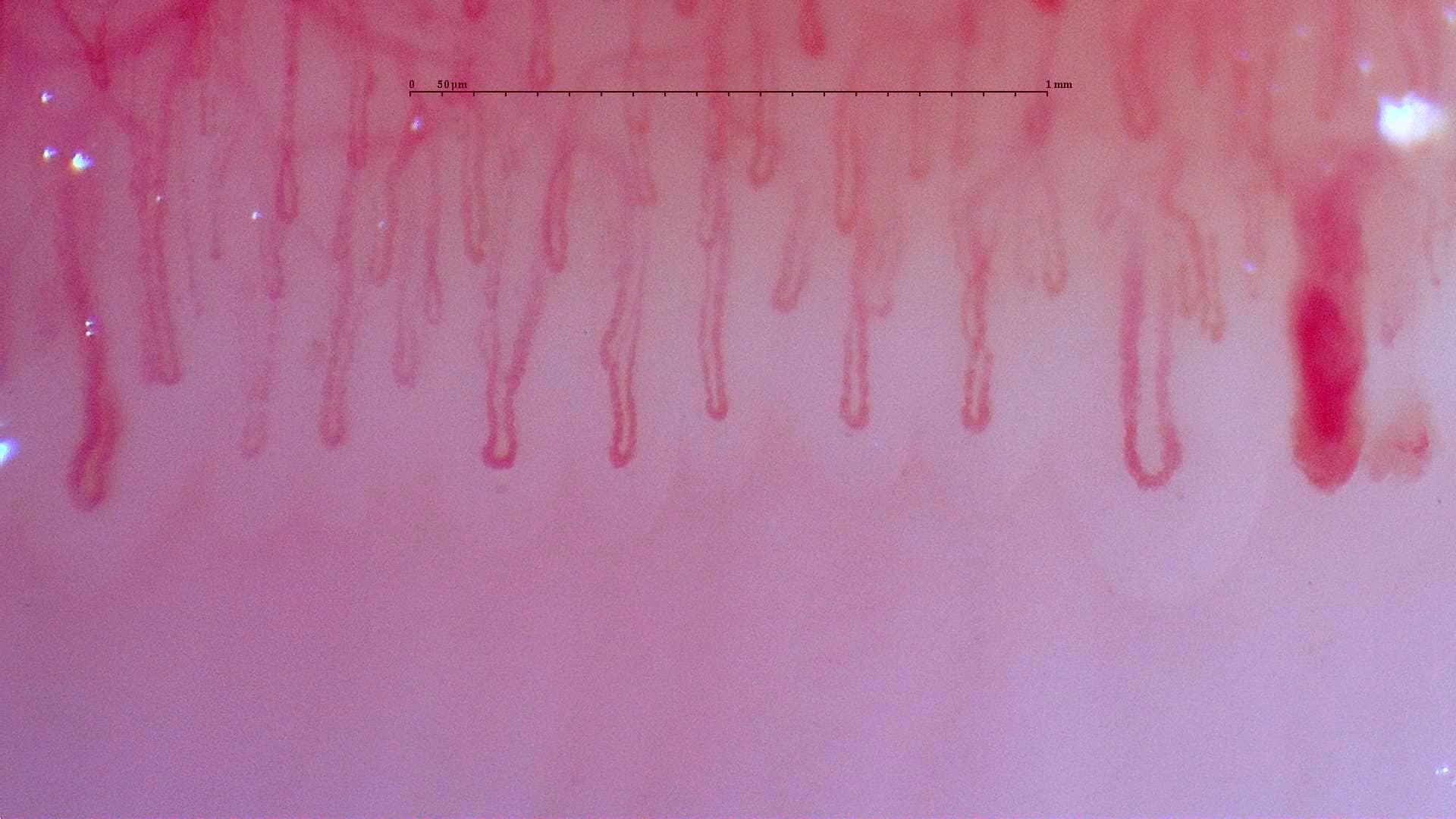Capillaroscopy example with Smart G-Scope