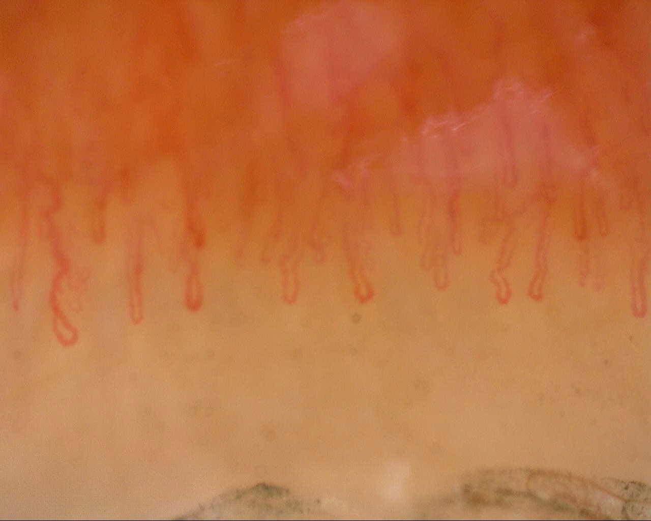 Capillary detail with Dino-Lite