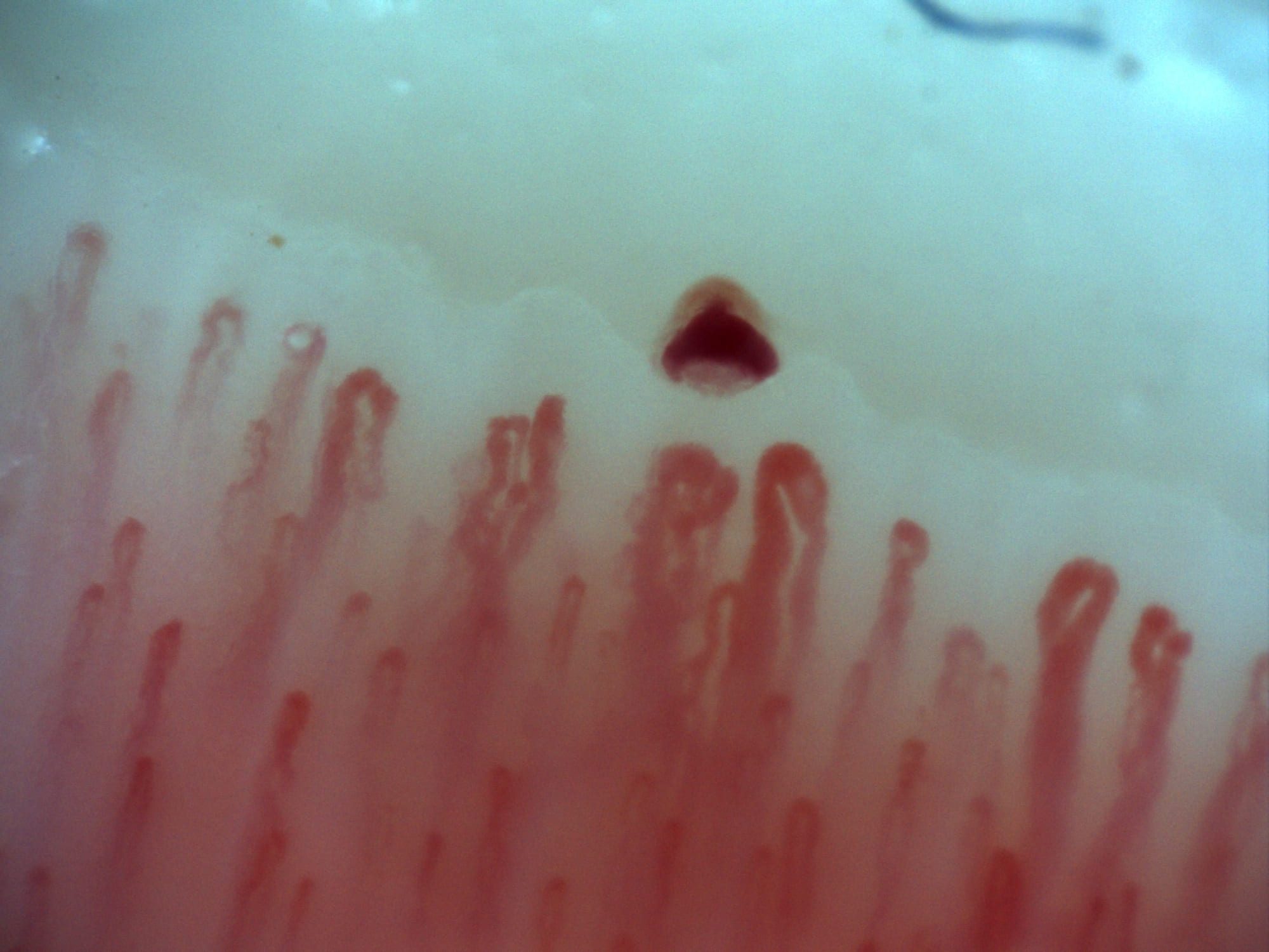 Capillaroscopy detail with Inspectis