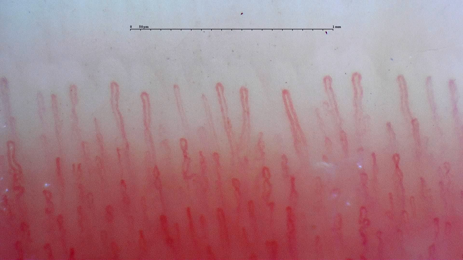 Image captured with Smart G-Scope