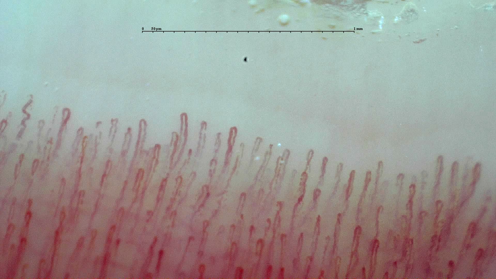 Assessable nailfold image
