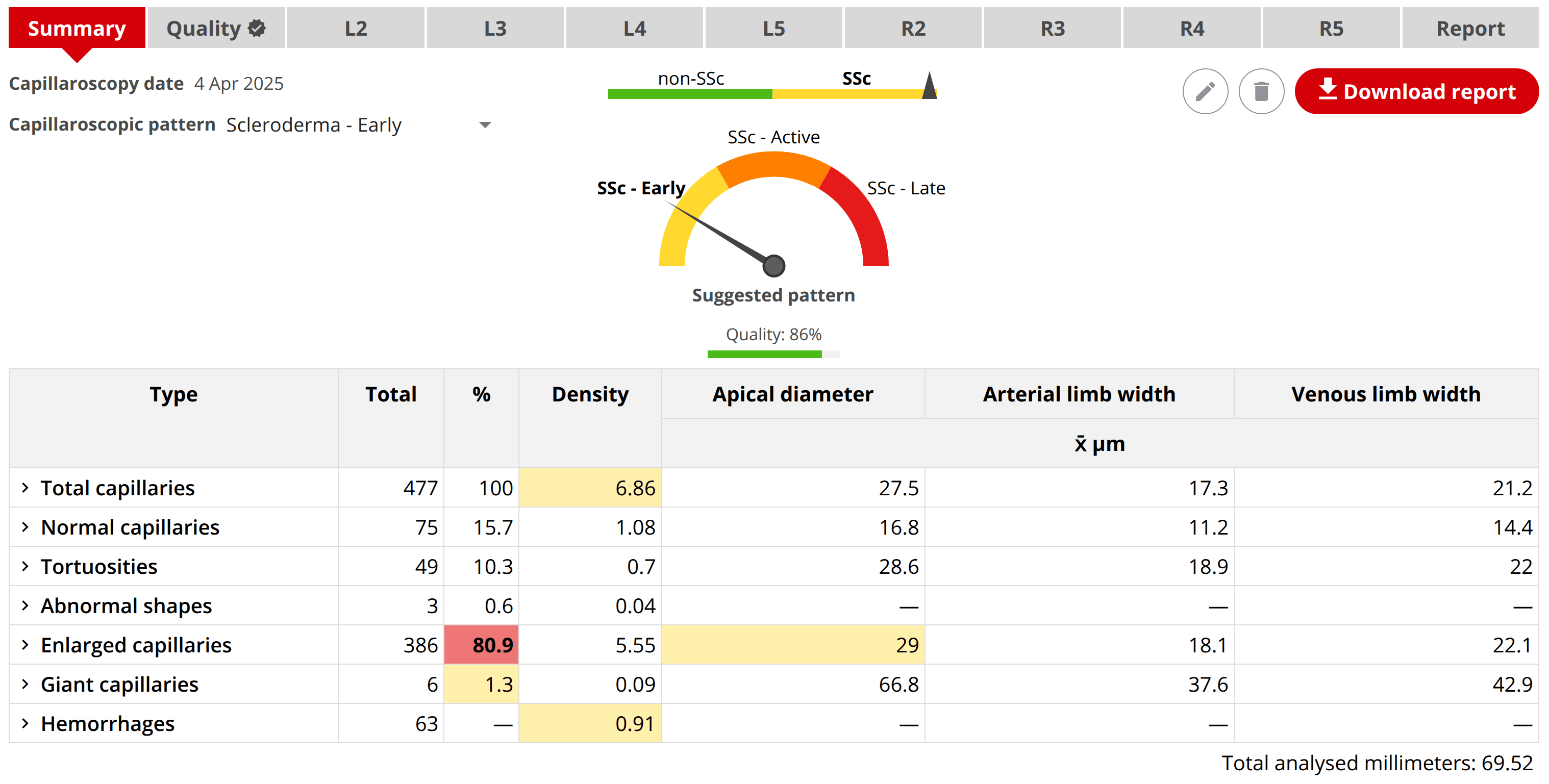 Capillary.io screenshot for capillaroscopy analysis